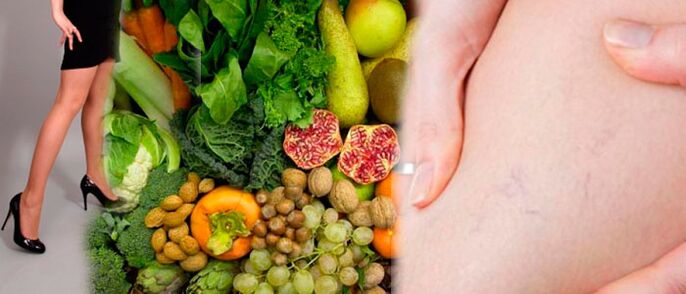 Diet for varicose veins