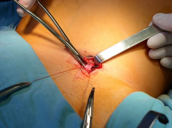 operation